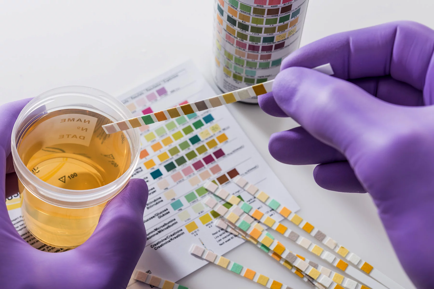 NANS Calls for Drug Tests for Politicians