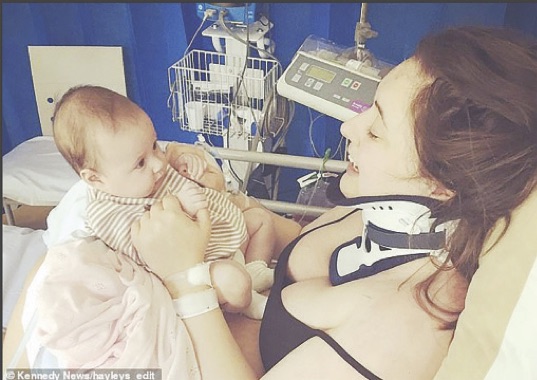 Young woman breaks neck after excessive yawning